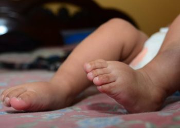 Una bebé cae de manos del personal de salud al nacer, el Sedes anuncia sanciones
