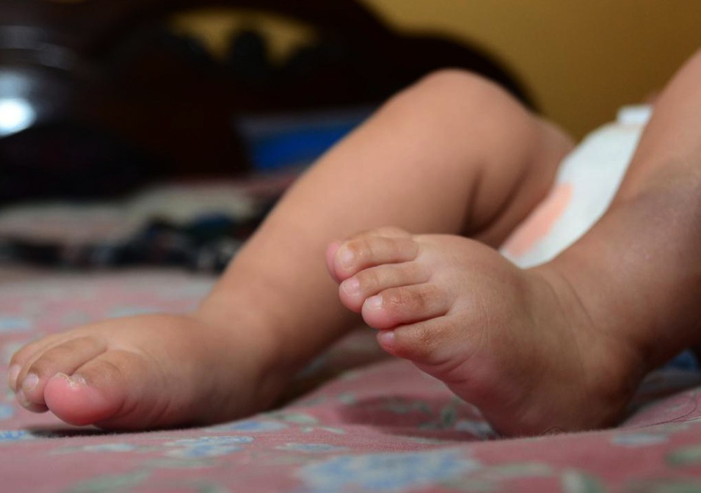 Una bebé cae de manos del personal de salud al nacer, el Sedes anuncia sanciones