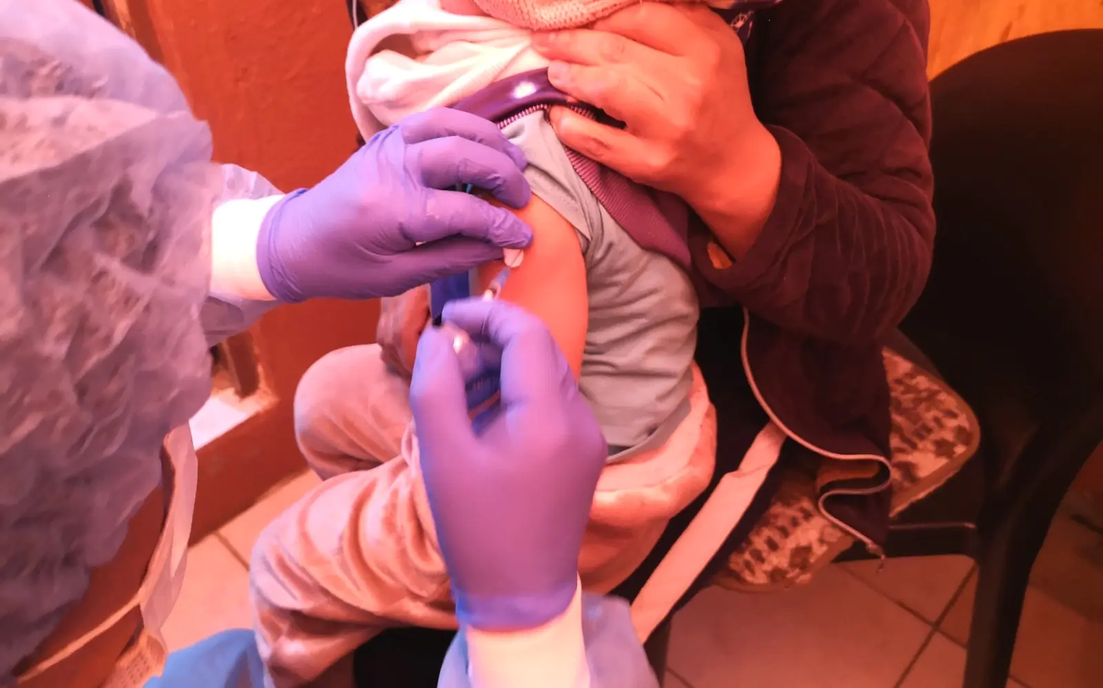 El Alto registra tres casos de coqueluche