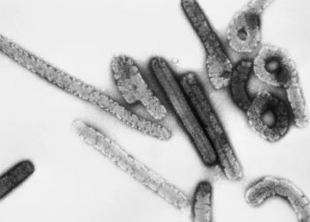 EEUU ofrece a Guinea Ecuatorial ayuda para responder al brote del virus.