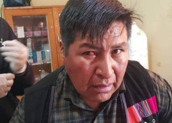 Edil de Potosí que retiró la silla a Morales renunció, afirma que es para cuidar la integridad de su familia. Foto: RRSS.