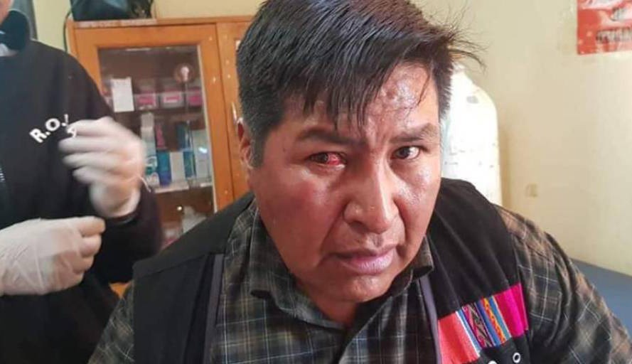 Edil de Potosí que retiró la silla a Morales renunció, afirma que es para cuidar la integridad de su familia. Foto: RRSS.