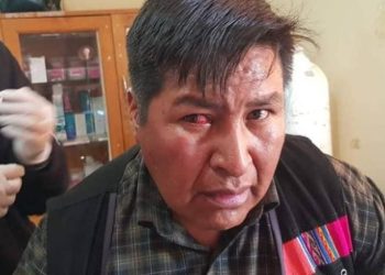 Choque fue expulsado de su ayllu por retirar la silla a Morales, autoridades originarias niegan agresiones a su familia. Foto: RRSS.