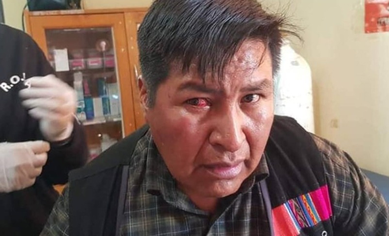 Choque fue expulsado de su ayllu por retirar la silla a Morales, autoridades originarias niegan agresiones a su familia. Foto: RRSS.