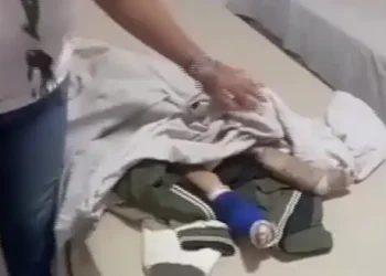 La víctima tenía múltiples laceraciones en el cuerpo y fracturas en los miembros inferiores. FOTO: RRSS