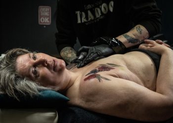Jacqueline van Schaik, superviviente de un cáncer de mama, se tatúa las cicatrices de su doble masectomía el 10 de enero de 2023 en un estudio en la ciudad holandesa de Lelystad. Foto: AFP.