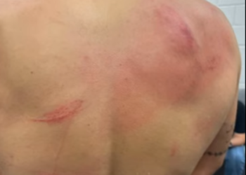 Bad Bunny golpeado