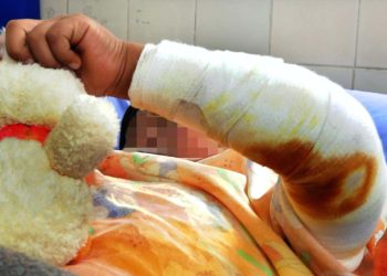 Tras más de 15 días de lucha, muere Patrick, el niño que cayó a una olla con agua hirviendo