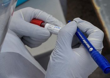 Agosto comienza con 18 personas fallecidas por COVID-19 en el país